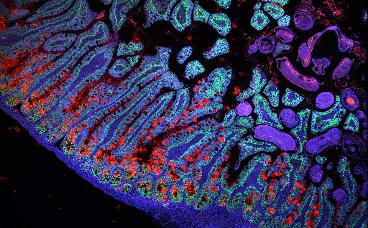 A section showing how many genes are turned on to develop the lower intestine