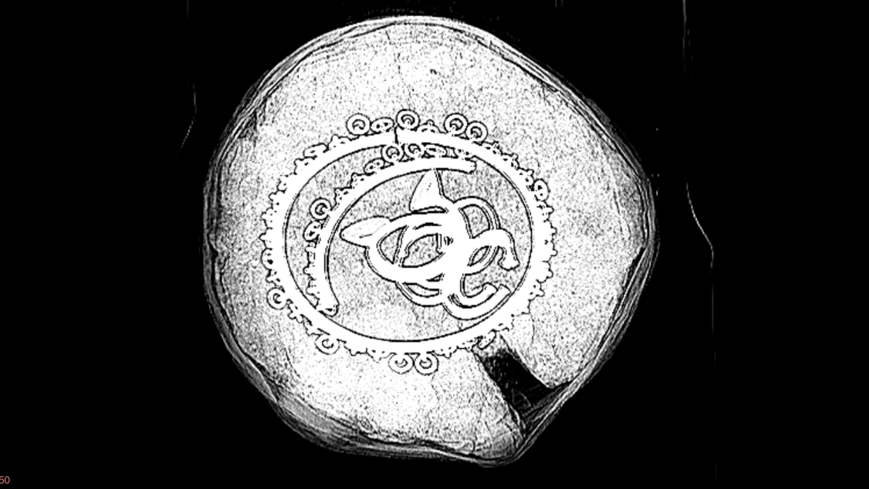The X-ray image is black and white. The white circle is the block of soil with the various bronze objects in the middle of it.