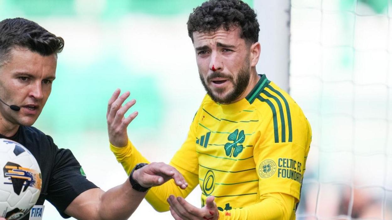 Mikey Johnston complains to the referee after suffering a facial injury following a challenge playing for Celtic against Hibernian on 11 August