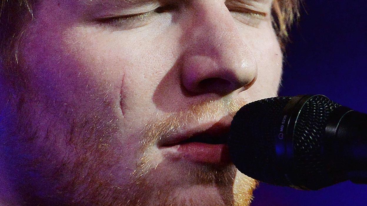 Scar on Ed Sheeran