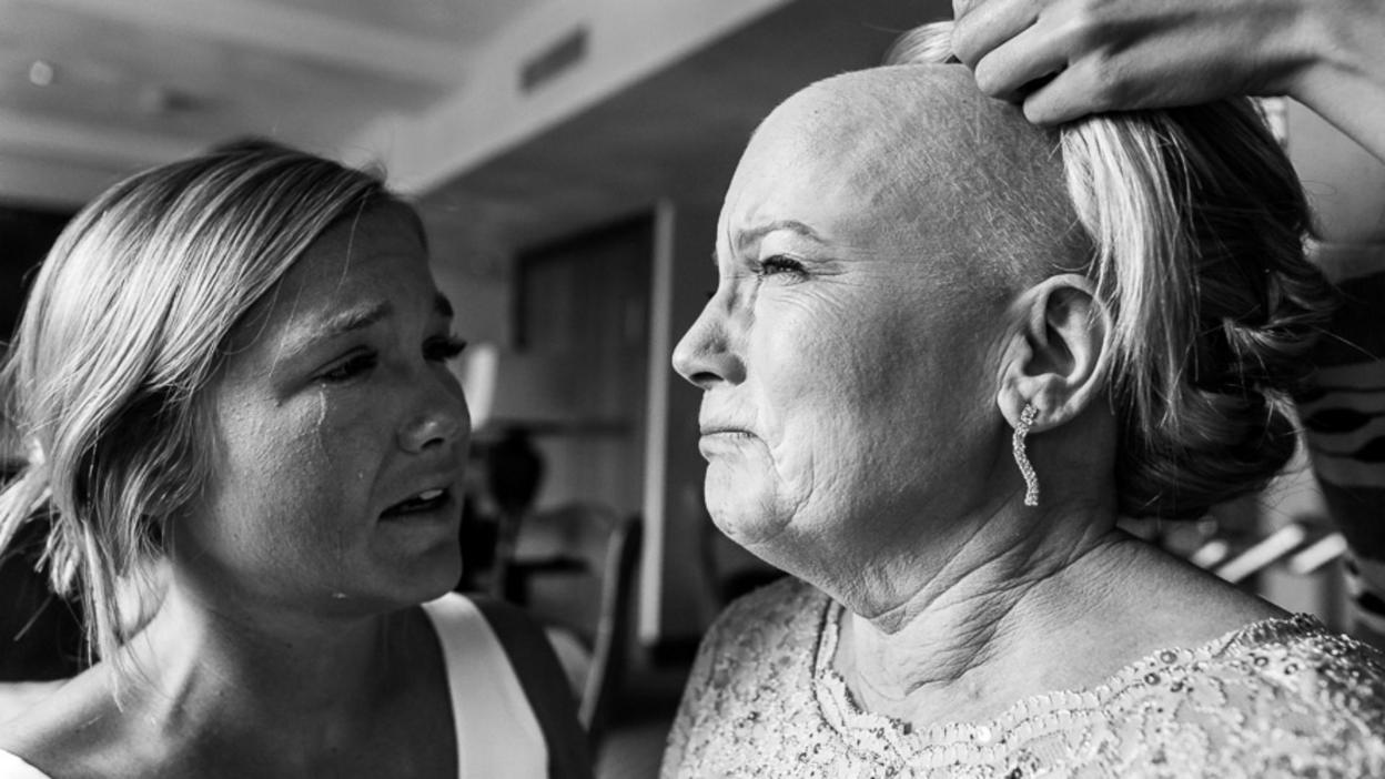 A woman who has lost her hair following chemotherapy has a wig fitted on her daughter