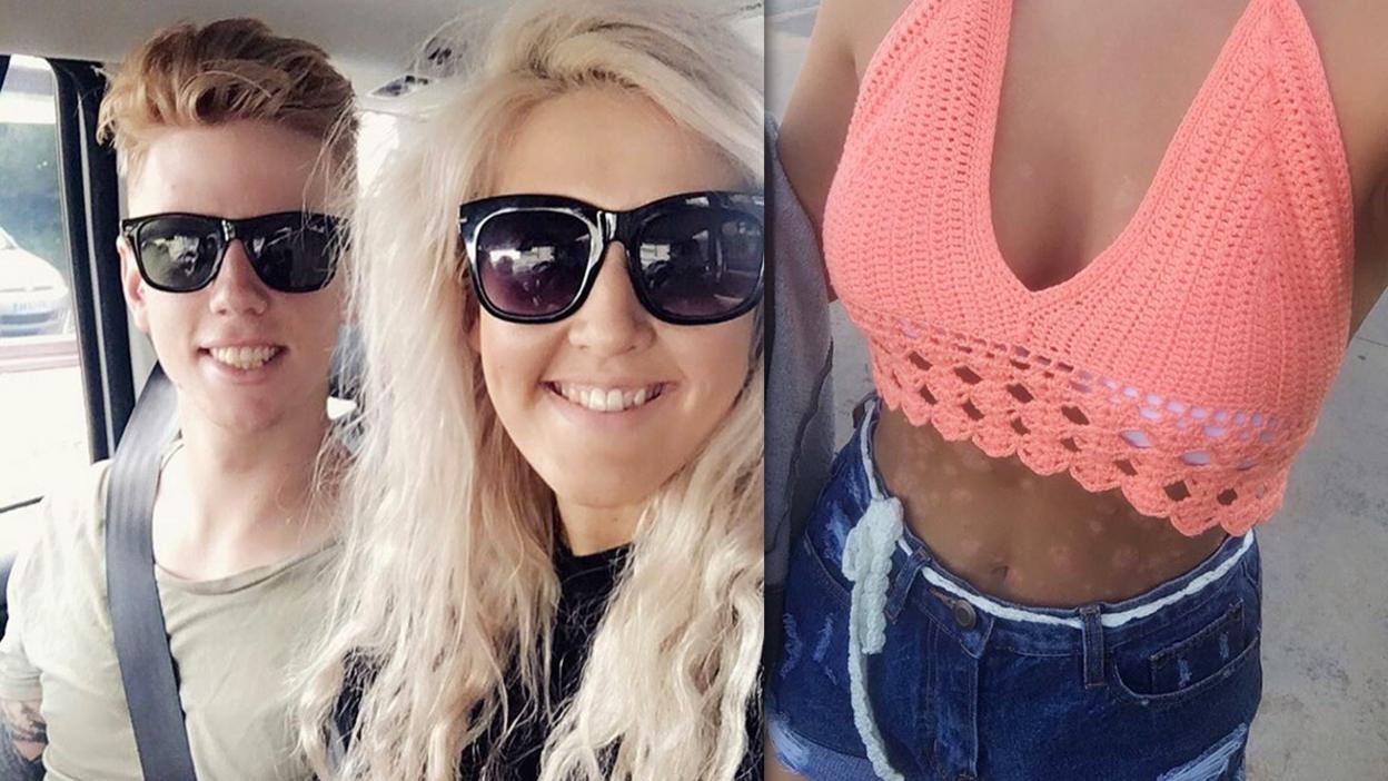 Bryony and her boyfriend, and dressed up to show off her skin.