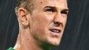 Joe Hart