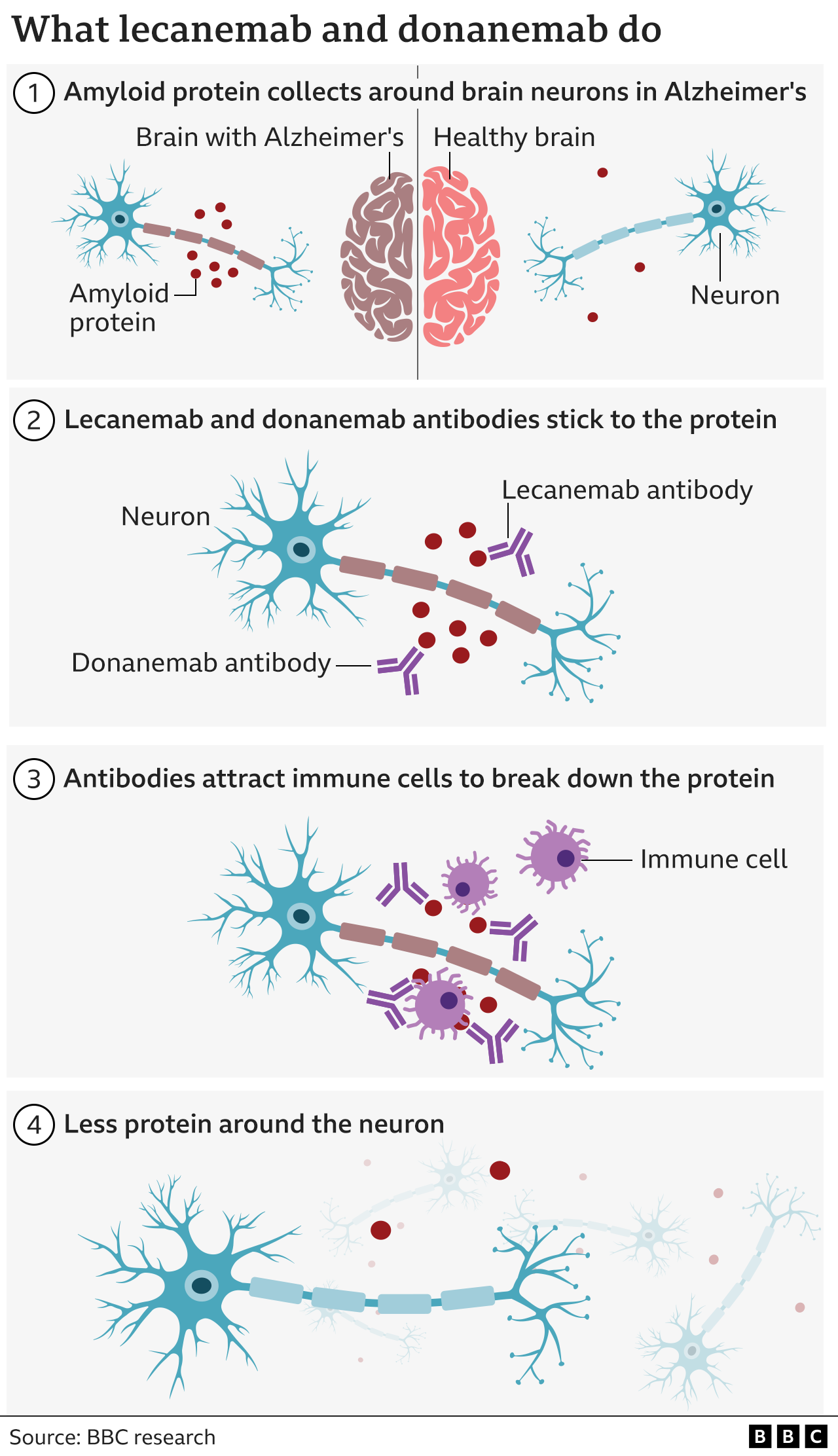 Graphic: What lecanemab and donanemab do