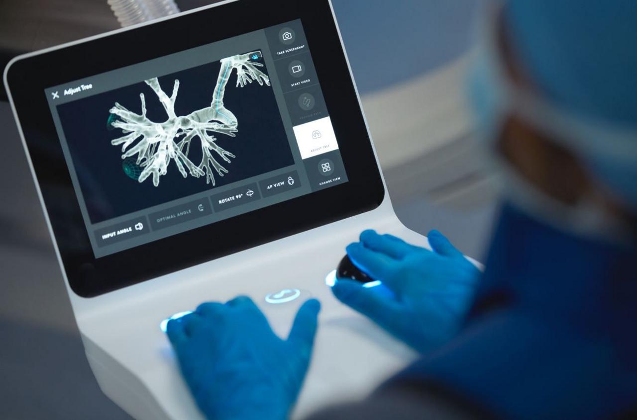 A Wythenshawe Hospital clinician, wearing blue gloves, examines a small screen while operating the new robotic probe.