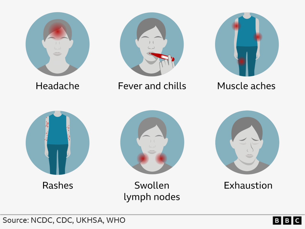 Graphic showing some mpox symptoms: headache, fever and chills, muscle aches, rashes, swollen lymph nodes and exhaustion. 