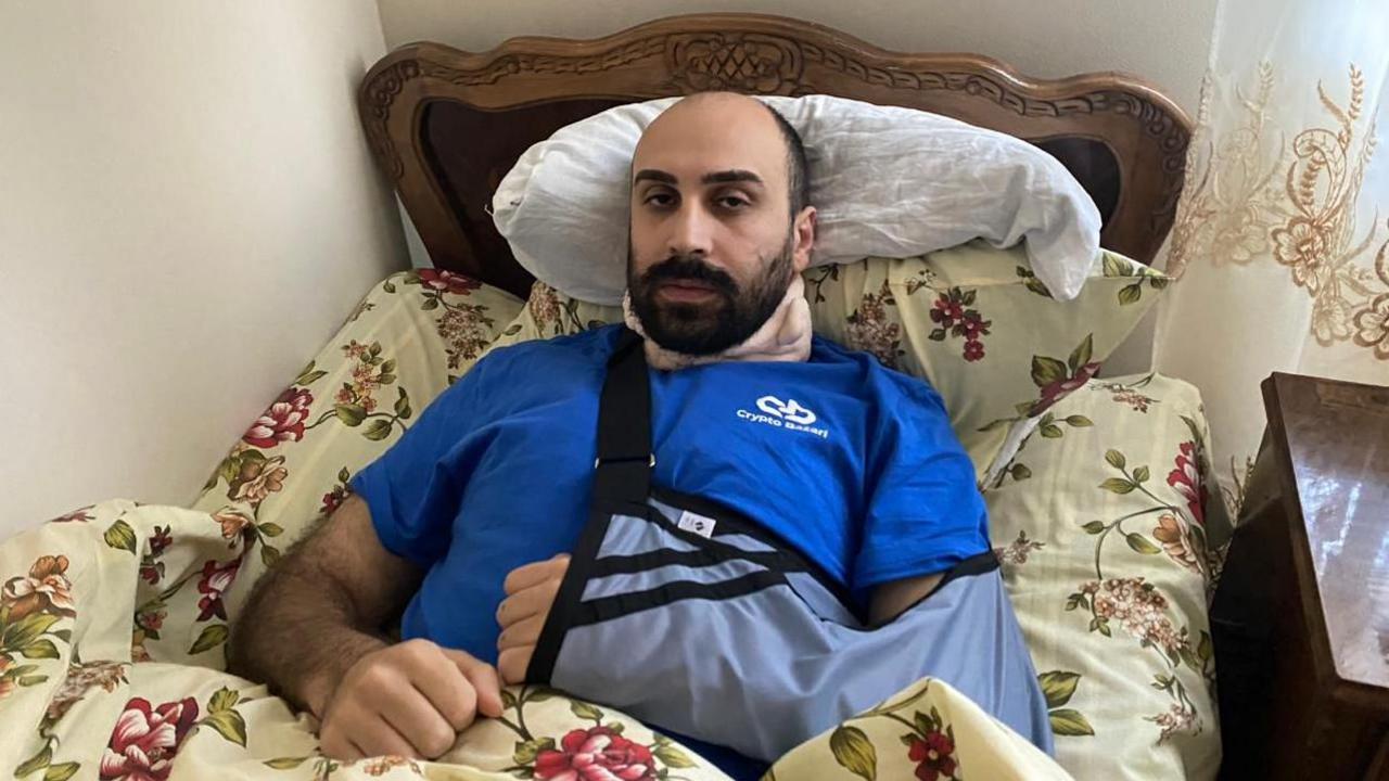 A Georgian man called Avandtil Kuchava lies in bed recovering from severe injuries suffered during a protest from police