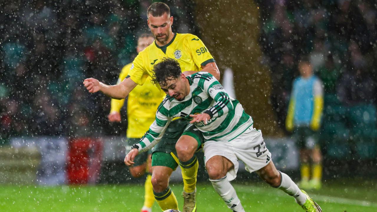 O'Neill Understands Hibs Fans' Dilemma but Expects No Impact on Celtic Clash — image 3