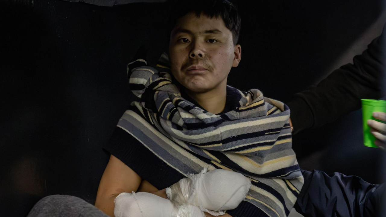 A man who is a reported North Korean prisoner of war looks at the camera, wearing a sweater around the top half of his torso and bandages around his hands