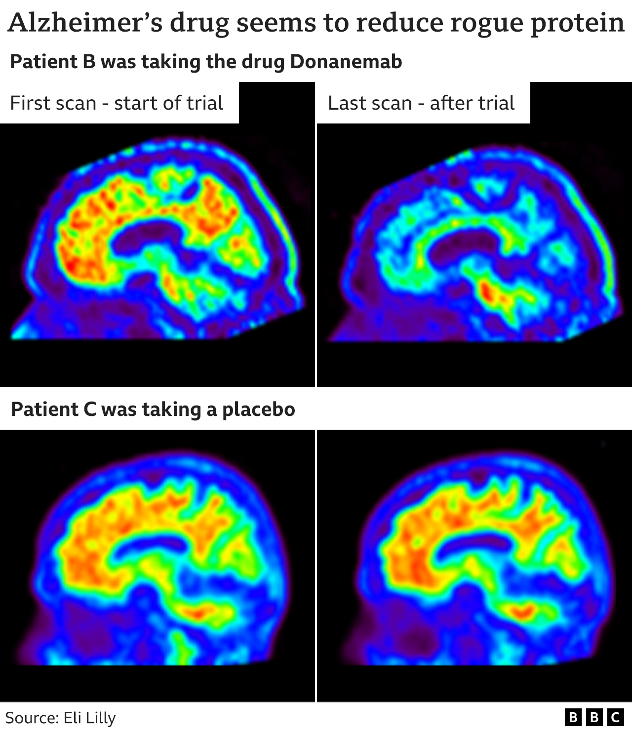 Brain scans