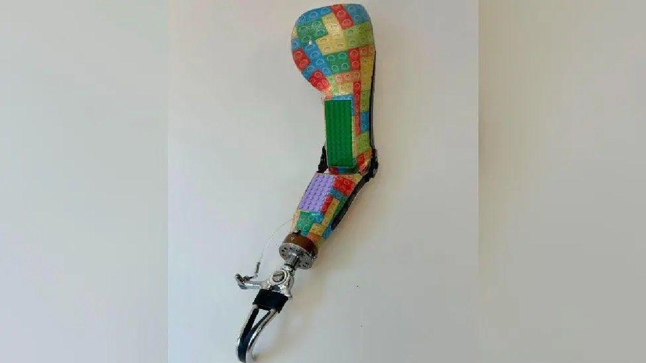 Tobi's lego-inspired prosthetic arm