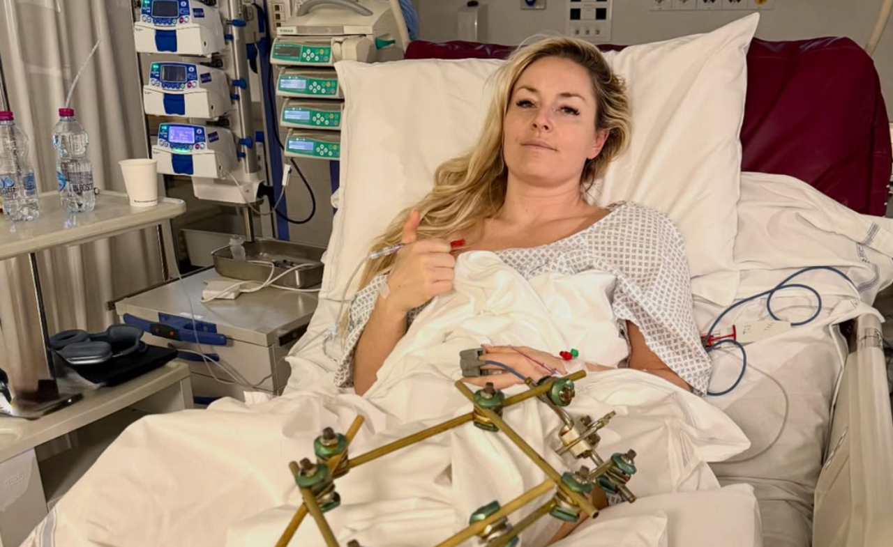 Lindsey Vonn Faces at Least 18 Months of Recovery After Olympic Crash, Unsure of Future — image 5