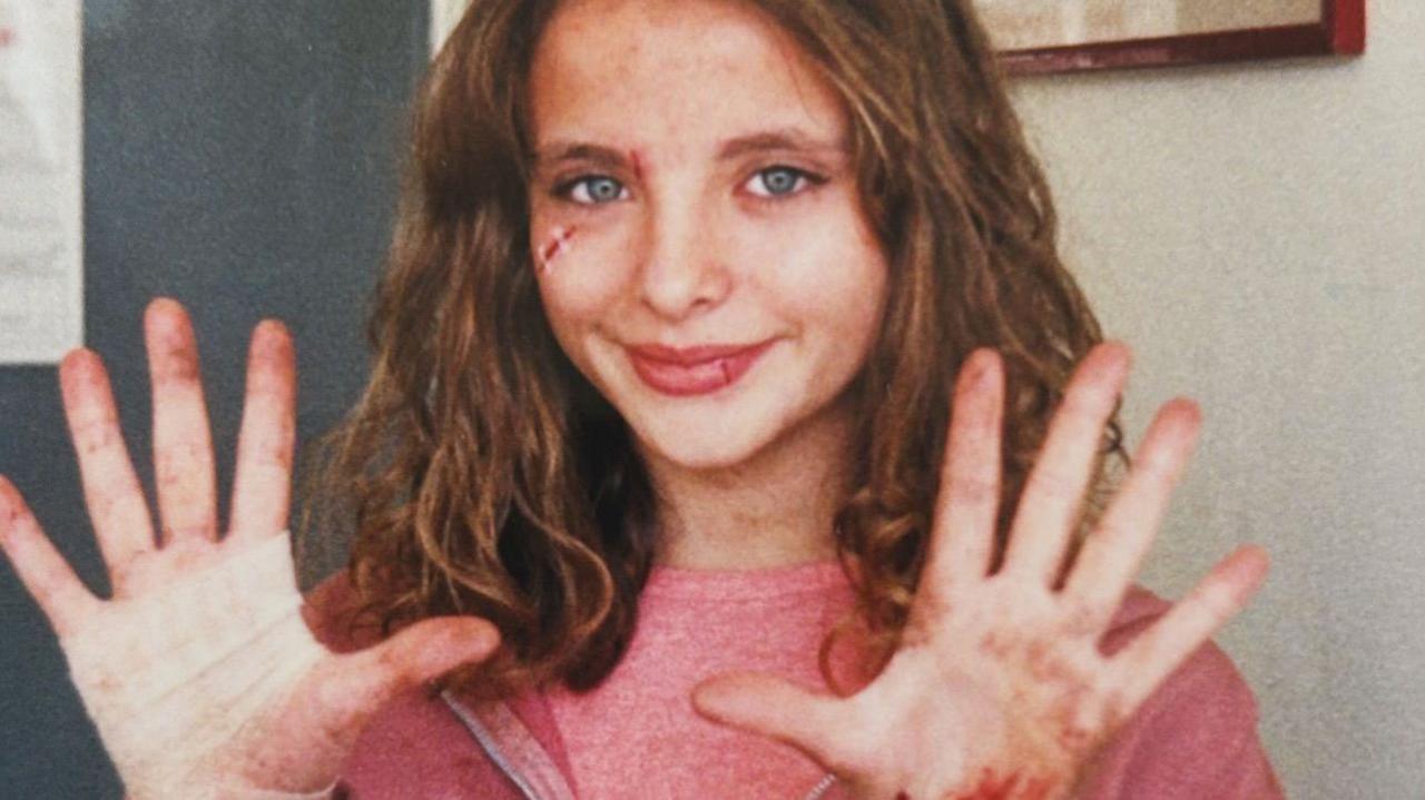 A girl with curly hair, wearing a pink hoodie and shirt, holds up both hands with red stains on the palms and fingers. She has some facial injuries too and is covered in mud.