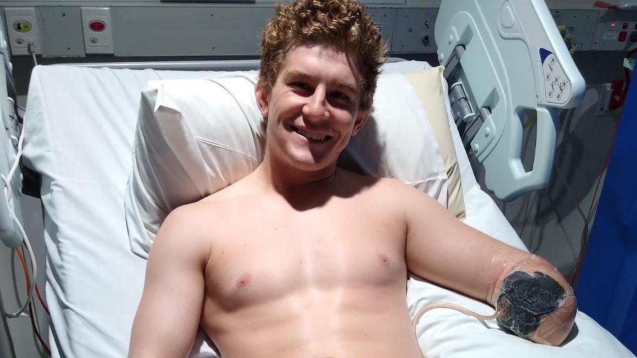 Henry Dunn in a hospital bed shortly after having his left arm amputated beneath his elbow. He is smiling and has no top on