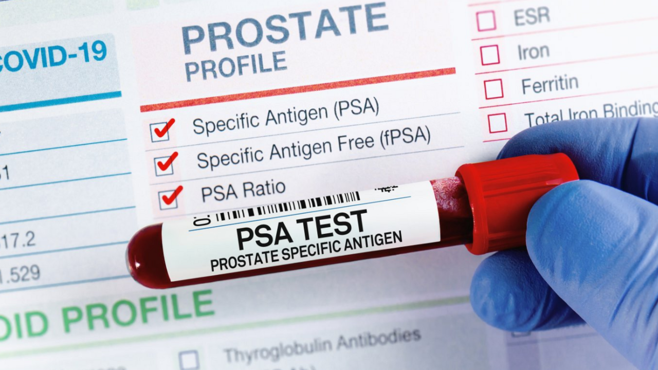 A generic shot of a close-up gloved hand holding a test tube with blood in it saying 'PSA Test' and Prostate Specific Antigen. There is a white data card behind with ticks against certain tests