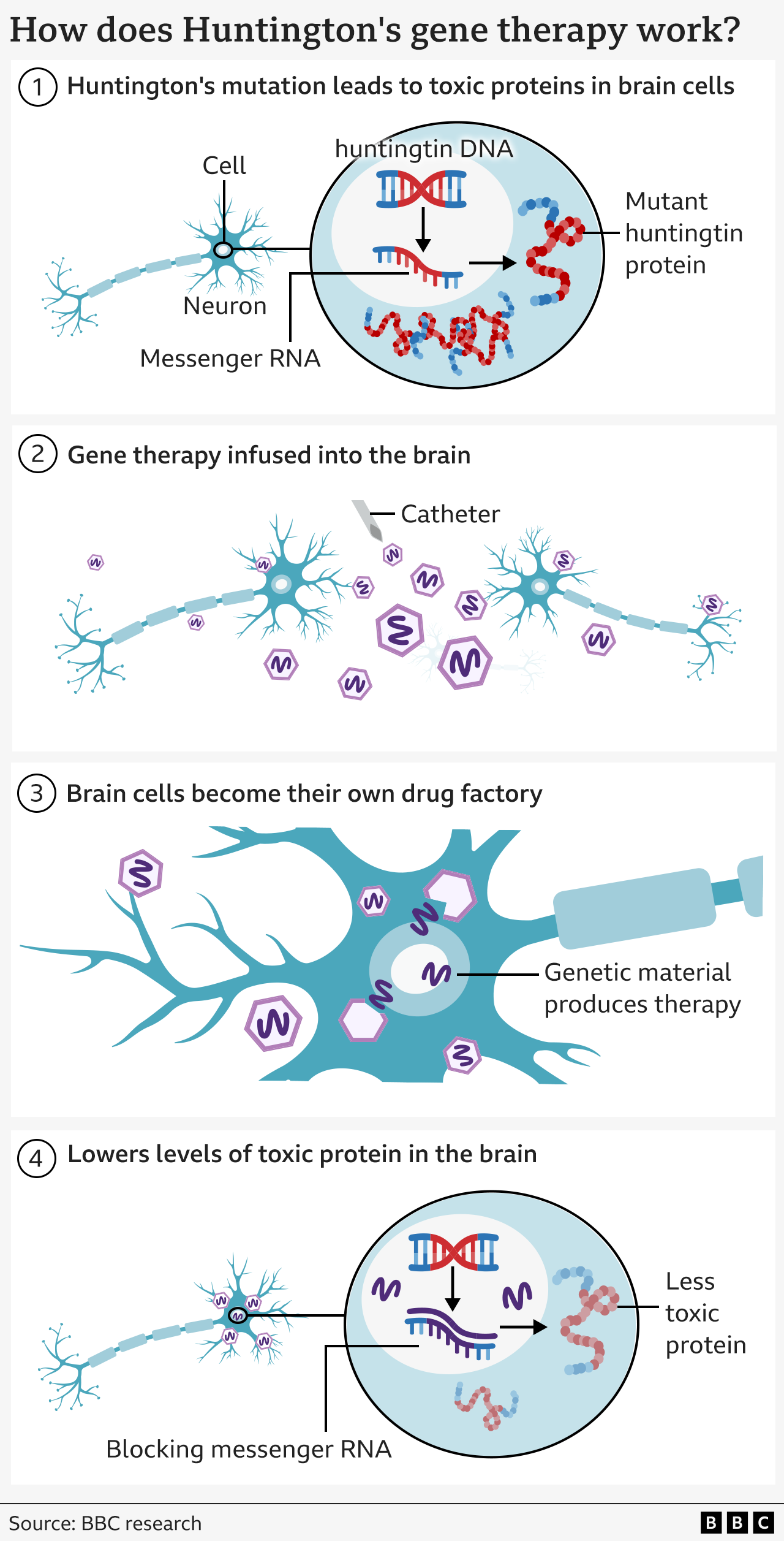 Graphical illustration of how the therapy works separated into four tiles. The first shows a spindly brain cell with a zoomed-in section showing a DNA double helix in blue with a red section denoting the mutated DNA and the build up of toxic protein, also red, inside the brain cell. Tile 2 shows two neurons and hexagonal viruses with a purple line in the middle. Tile 3 shows a close-up of the neurons from before with the viruses inside and releasing their purple squiggly line. Tile 4 goes back to the same zoomed-in view of a neuron, but this time the purple squiggles are sticking to the previous genetic code so there is less toxic protein being made, represented by it being shaded out. 