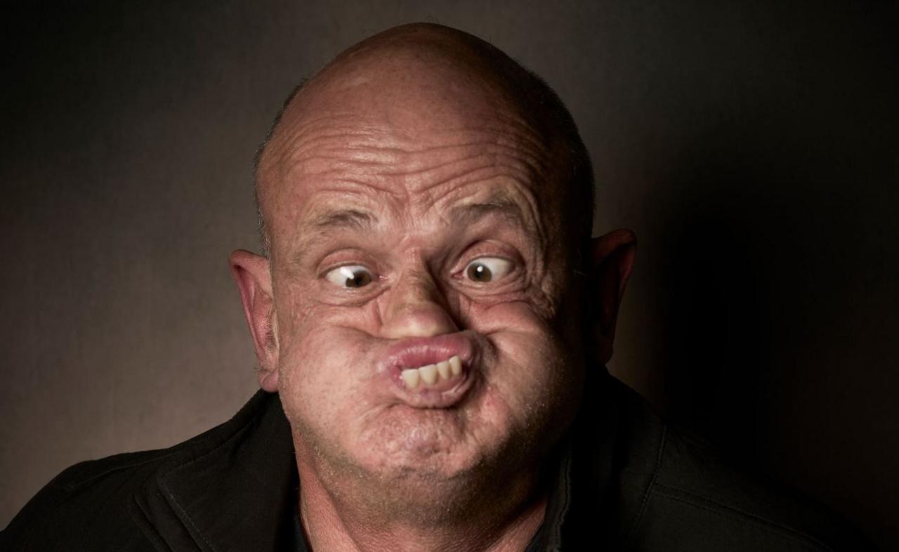 A bald man has his bottom teeth sticking out and his mouth pushed up under his nose, and his eyes are crossed