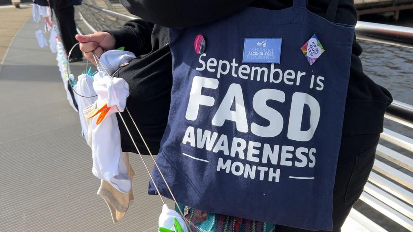 A bag bearing the message 'September is FASD awareness month' held by a volunteer putting up the baby clothes displayed on the footbridge