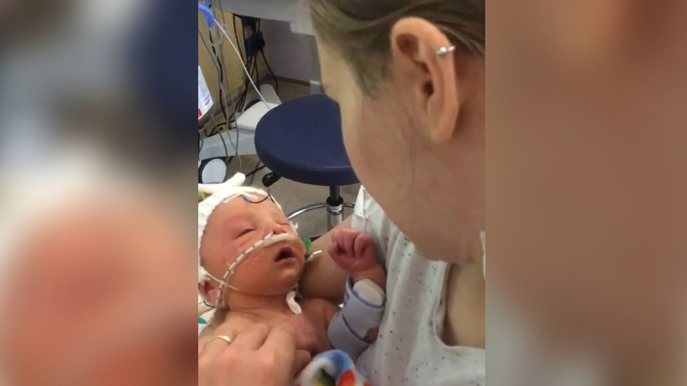 A mother stares down at her newborn, who has a medical tube across his face, from a hospital bed.