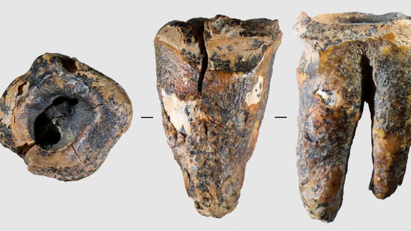 the neanderthal tooth