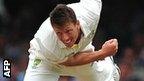 James Pattinson