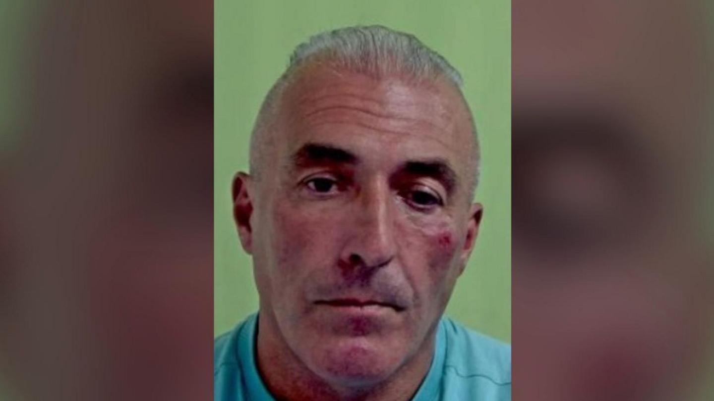 A headshot of Adrian Larcombe, a man with slicked-back grey hair and a long face. He is wearing a light blue T-shirt and appears to have a bloodied bruise near his eye on his left cheek.