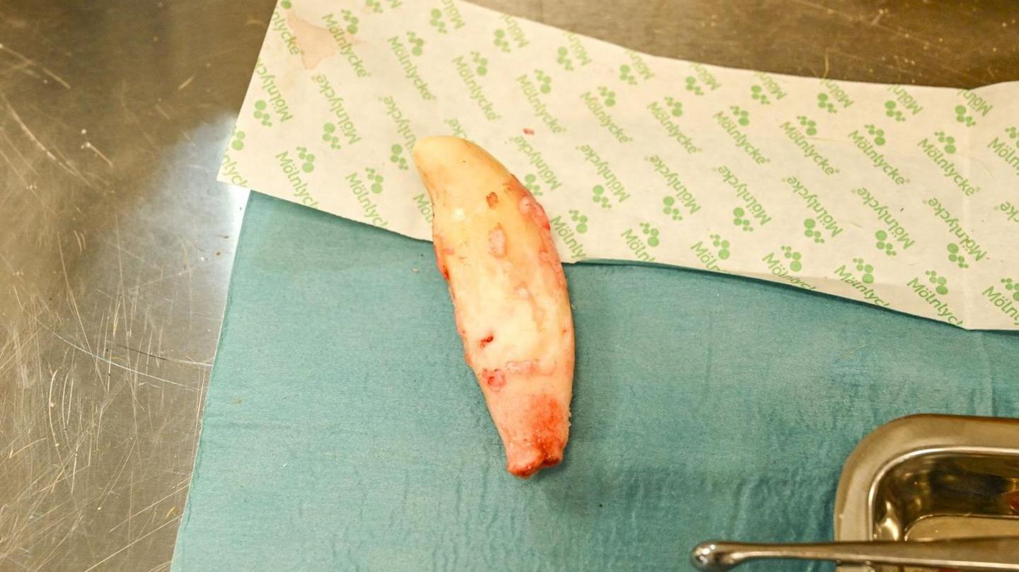 An extracted lion's lower canine which measures 8cm in length. It is placed on a surgery table.