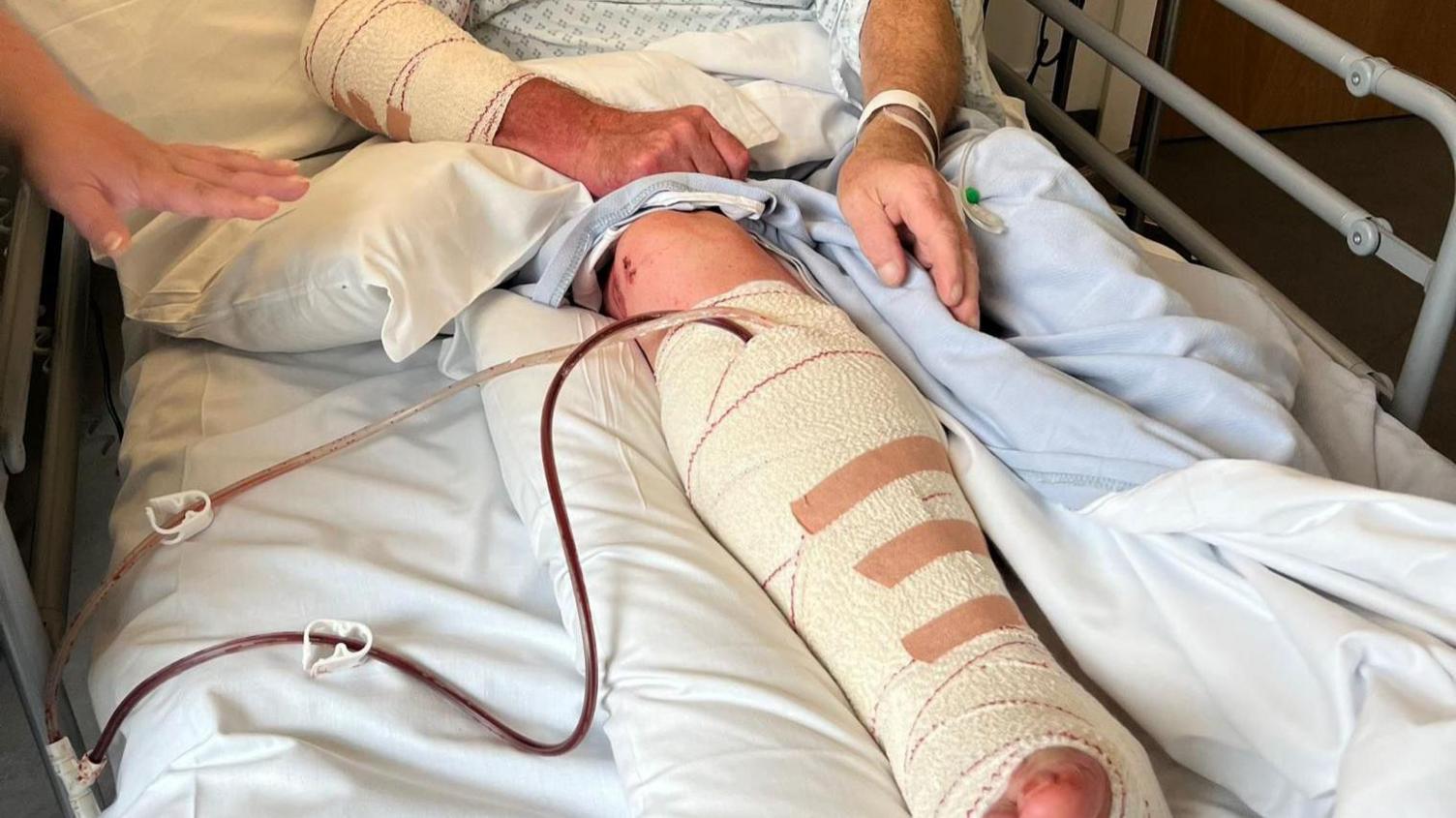 Mr Lockhart lying in a hospital bed, wearing blue and white patterned gown. His arm and leg are bandaged with gauze and medical tape, and there are tubes filled with red fluid running from the bandages. There are also several scrapes and bruises visible. 