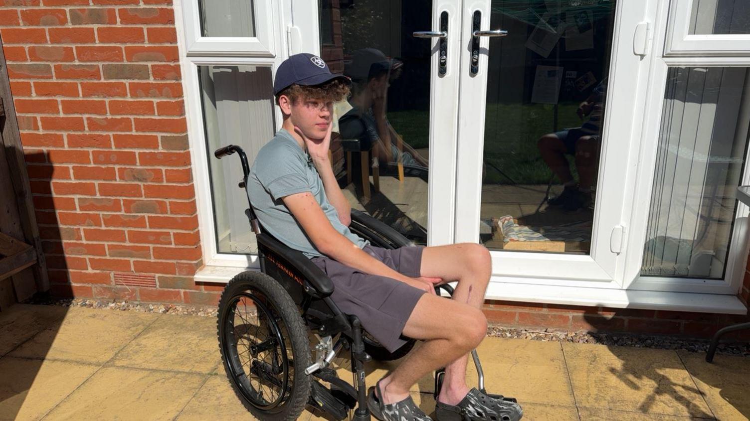 A young man in a blue cap and shorts and a grey tshirt sitting in a wheelchair, in front of some patio doors, with his hand supporting his head 