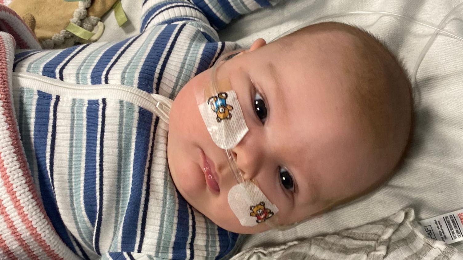 Jonah is pictured lying down in a bed. He has his eyes open and is looking away from the camera. He has a tube around his face that connects to his nose while a blanket rests over his lower half and he is wearing a stripey blue and white baby grow. 