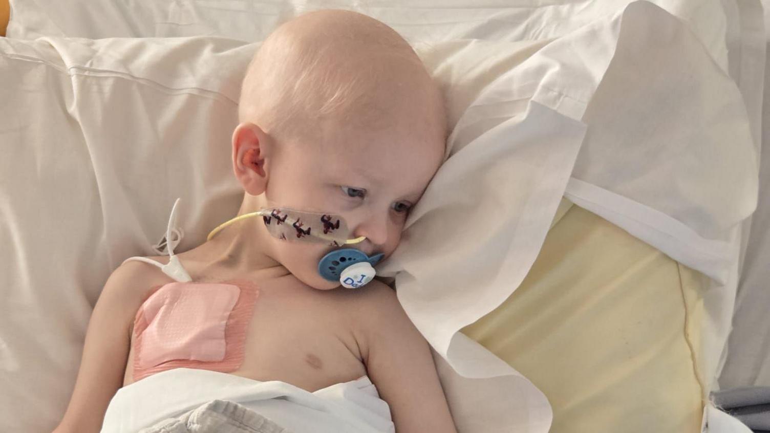 The photo shows Jonah lying in a hospital bed. He has lost much of his hair. He has a nasogastric tube inserted, and a large dressing on his chest with a wire coming from it. He has a blue dummy in his mouth and he is looking down and to the side.