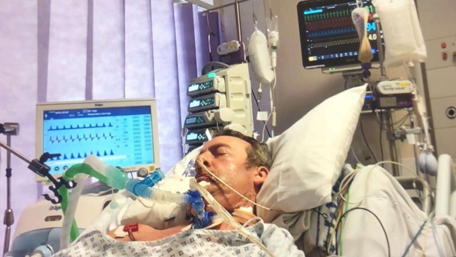 Laurence Penn while he was in an induced coma in Worthing Hospital in 2020.