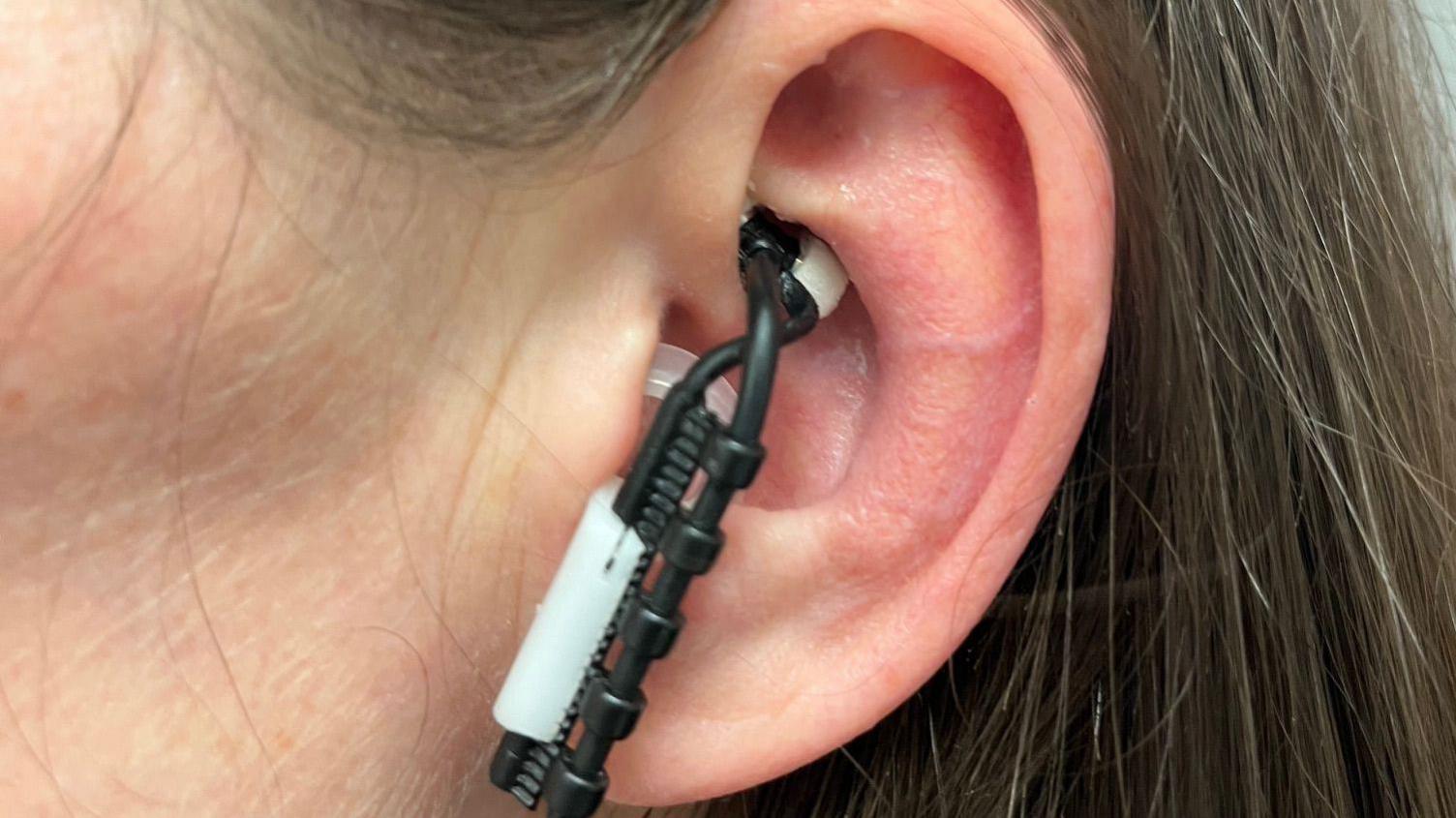 A medical earpiece lodged in an ear. The wearer has brown hair.