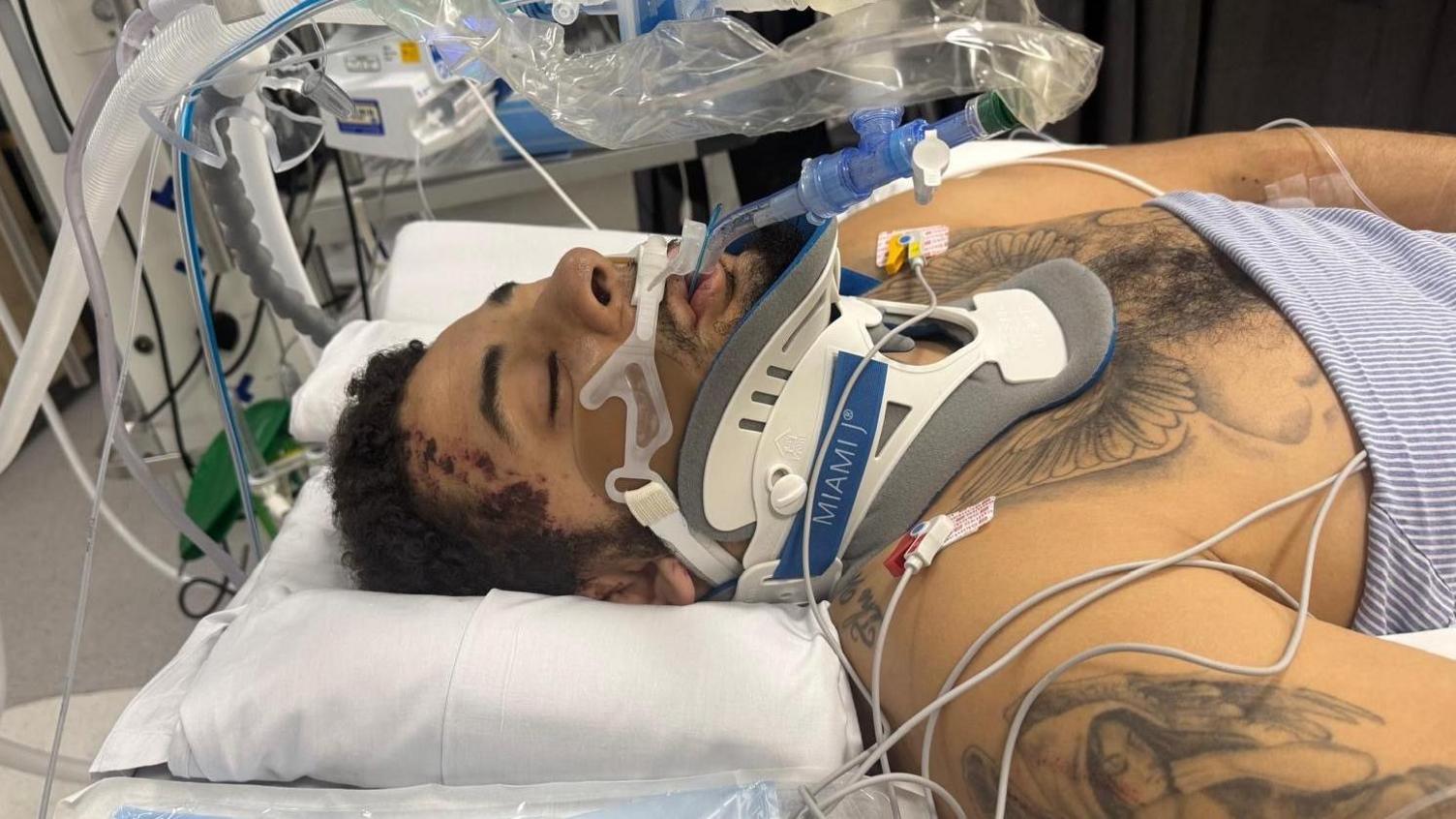 Jordan Chiedozie lying in intensive care with a neck brace and many other wires and tubes attached to him