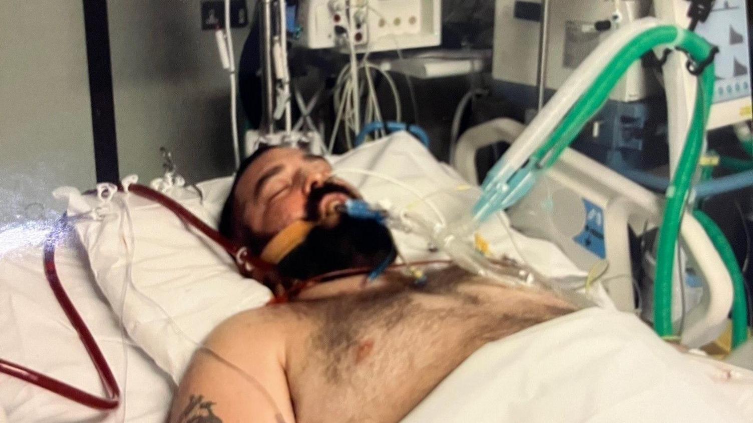 Scott Blackwell in a coma in hospital, on life support. He is lying on a bed and is connected to various wires and tubes.