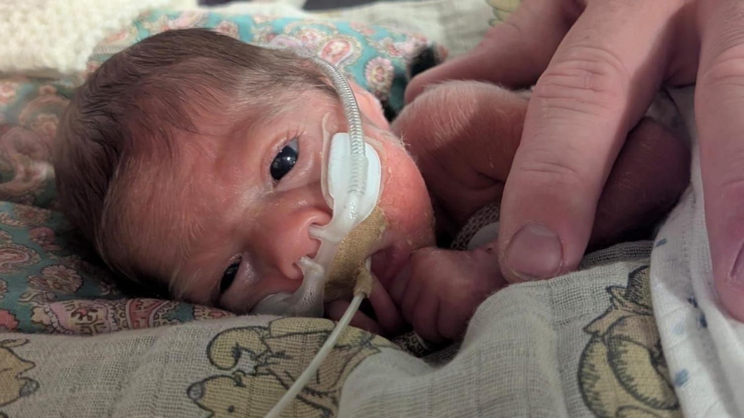 A close-up image of baby Wesley in hospital with tubes coming out of his nose.