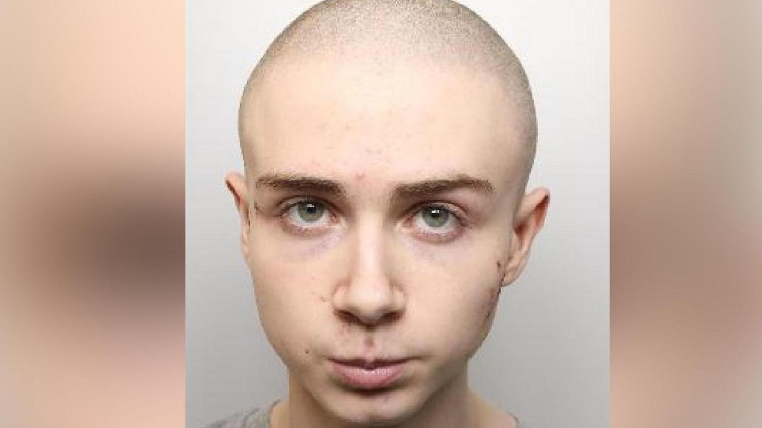 Louis Melotte mugshot. He has a shaved head, some cuts around his face and  neck, and green eyes.