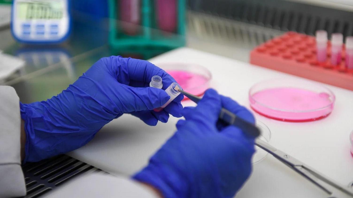 A close-up of two hands in purple medical gloves holding test tubes and a tweezer with a skin sample on it.