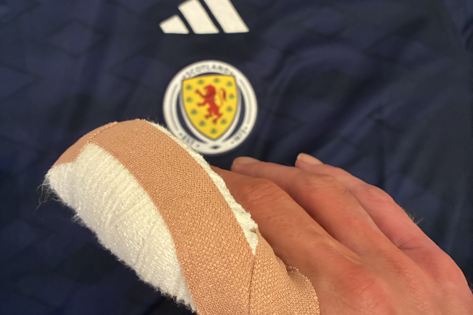 A hand with a heavily bandaged index finger rests on a navy Scotland football strip