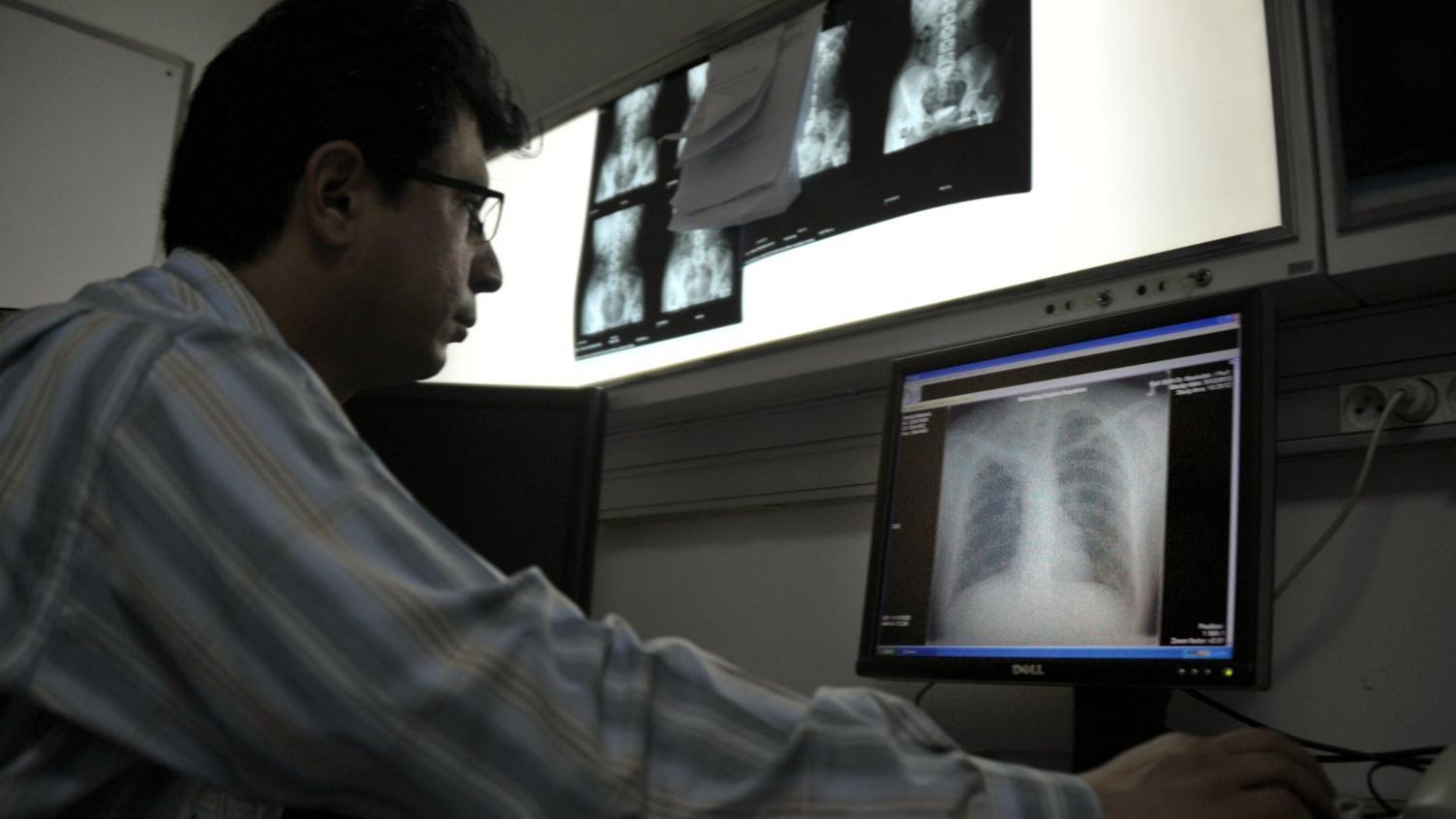 Doctor examining chest x-ray from a distant clinic