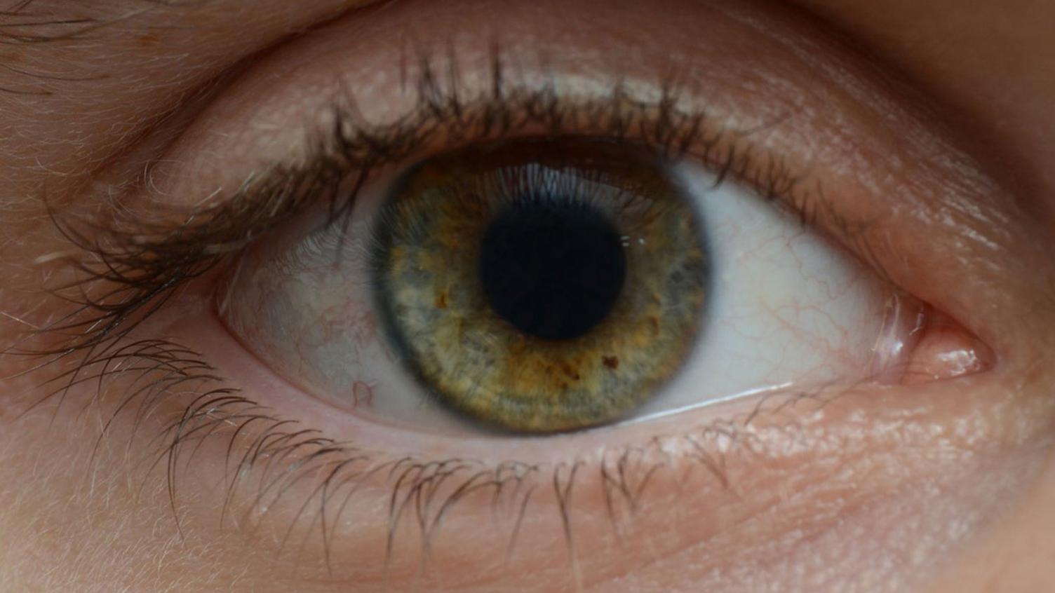 Eye