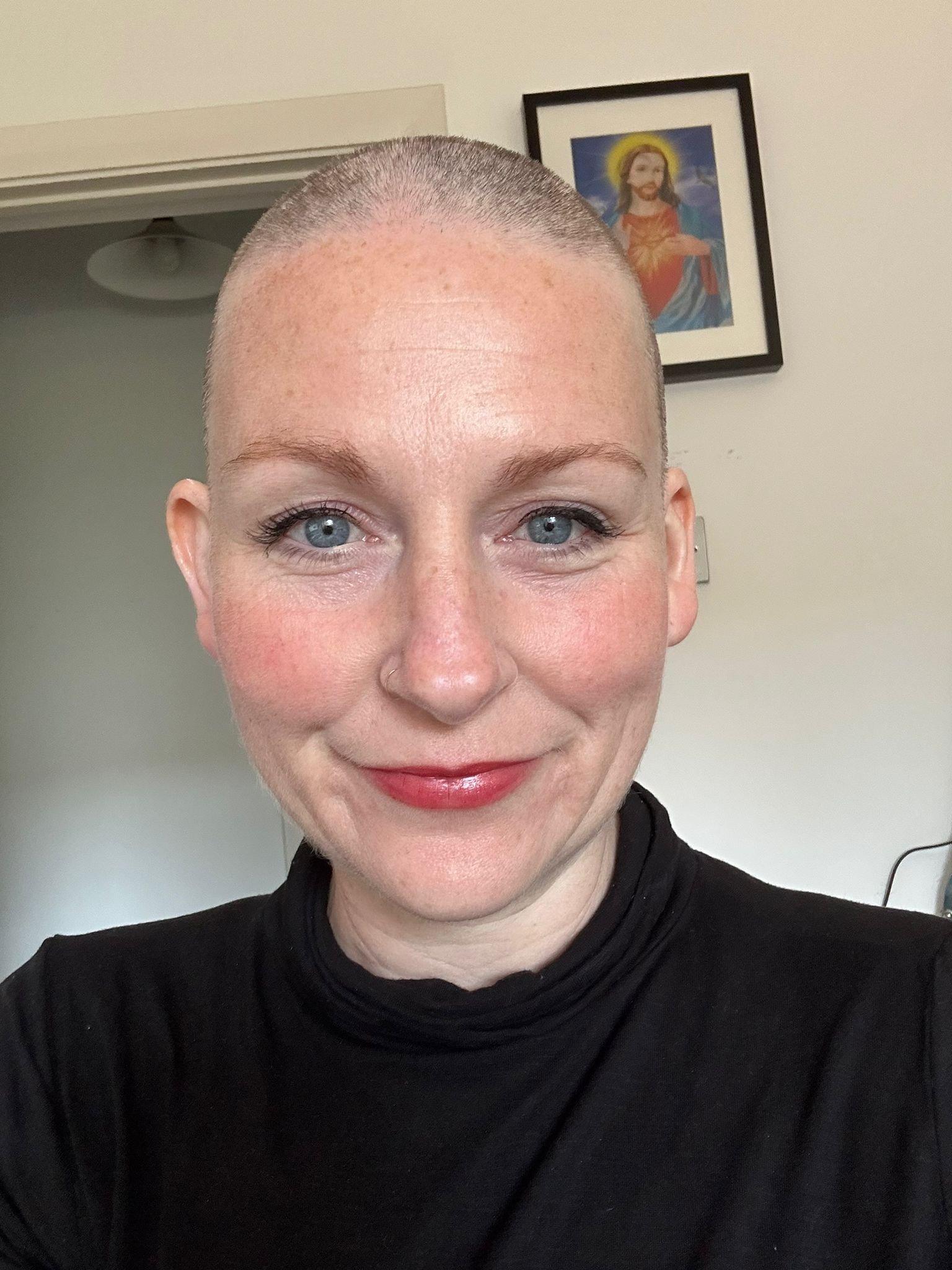 Claire O'Shea after shaving her head