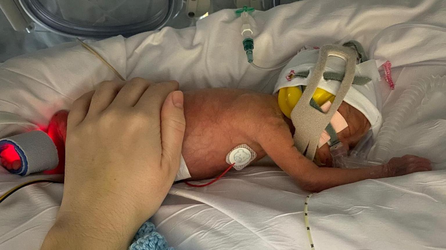 A picture of a small baby in an incubator. A hand can be seen holding Jacob, who is wearing a hat with a tube attached to his nose.