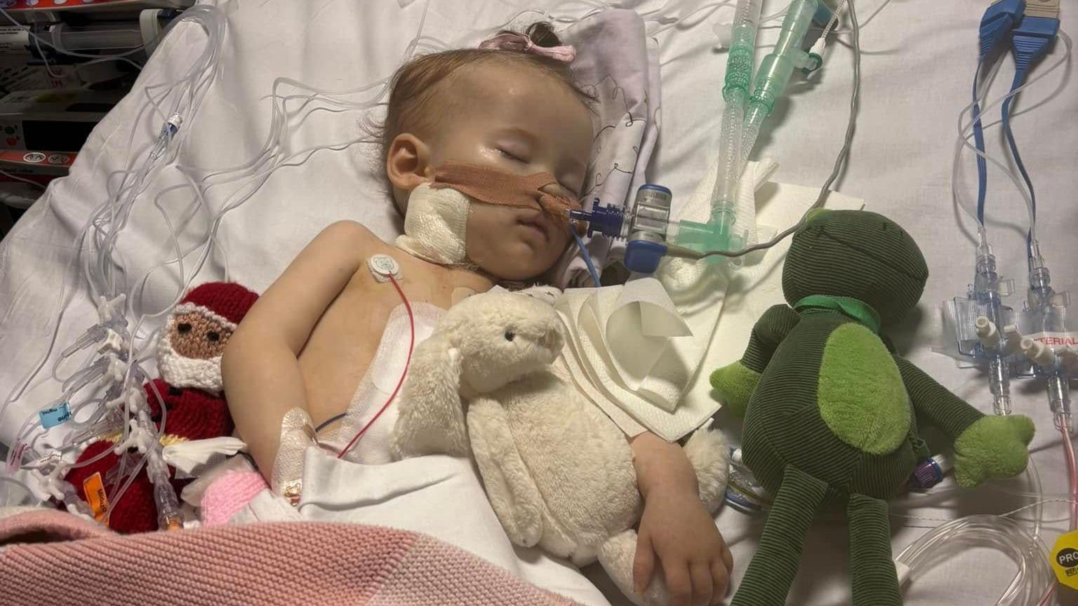 A toddler lies in a hospital bed, with tubes taped to her nose. She is sleeping and surrounded by cuddly toys.