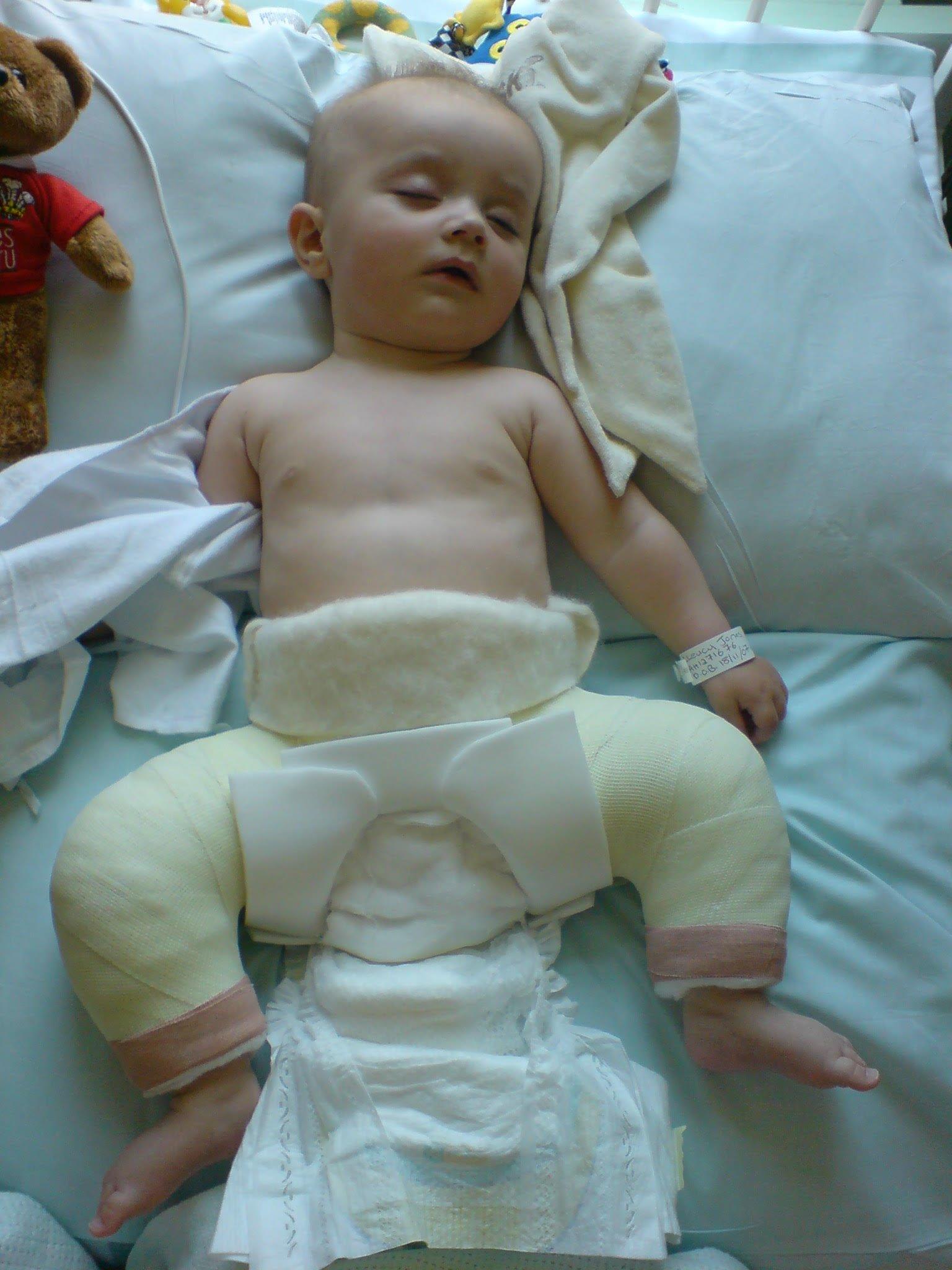Cyfnod pryderus pan oedd Lleucu yn cael triniaeth yn ysbyty Alder Hey, Lerpwl