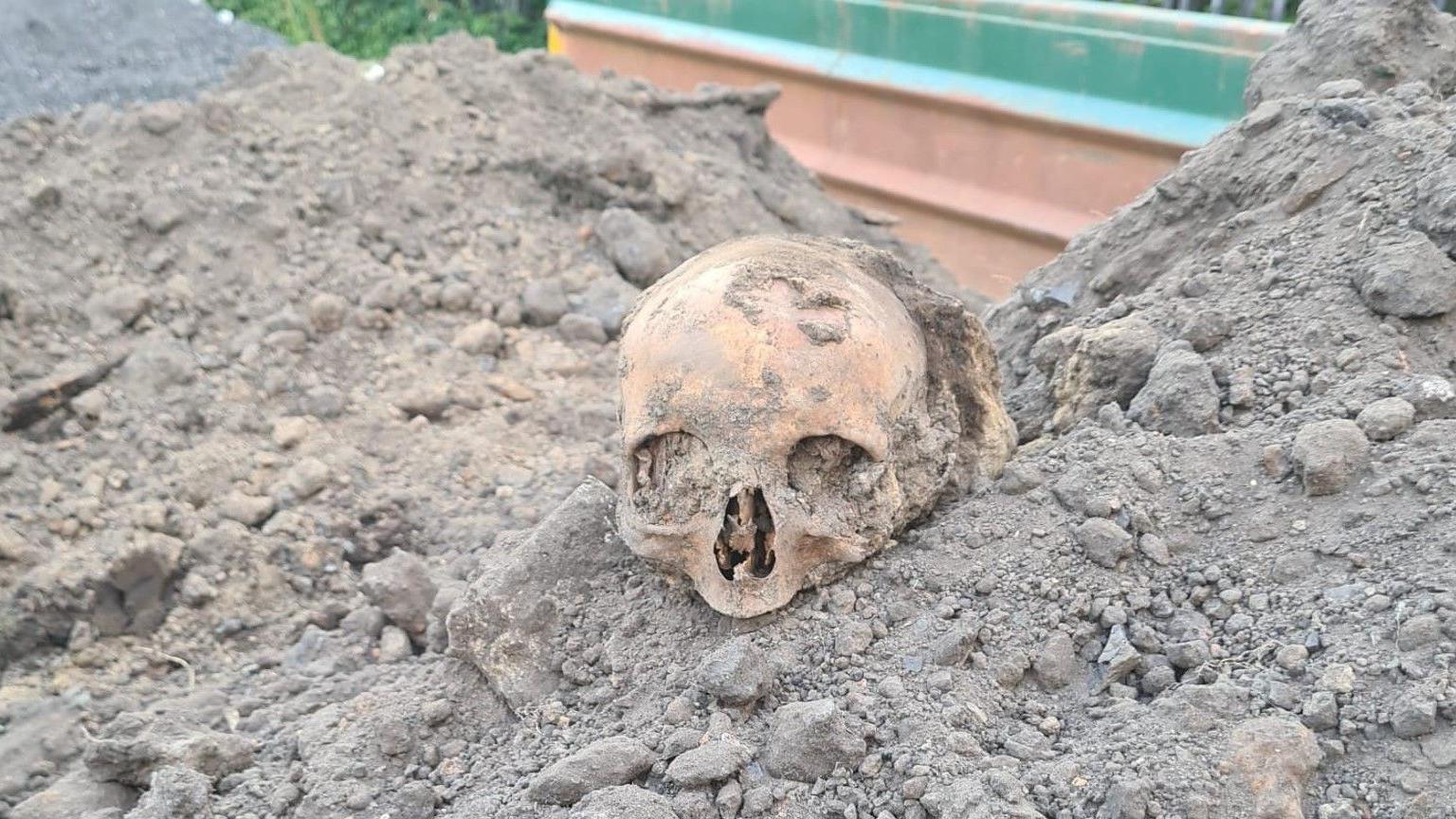 A skull in the centre of the image, surrounded by soil.