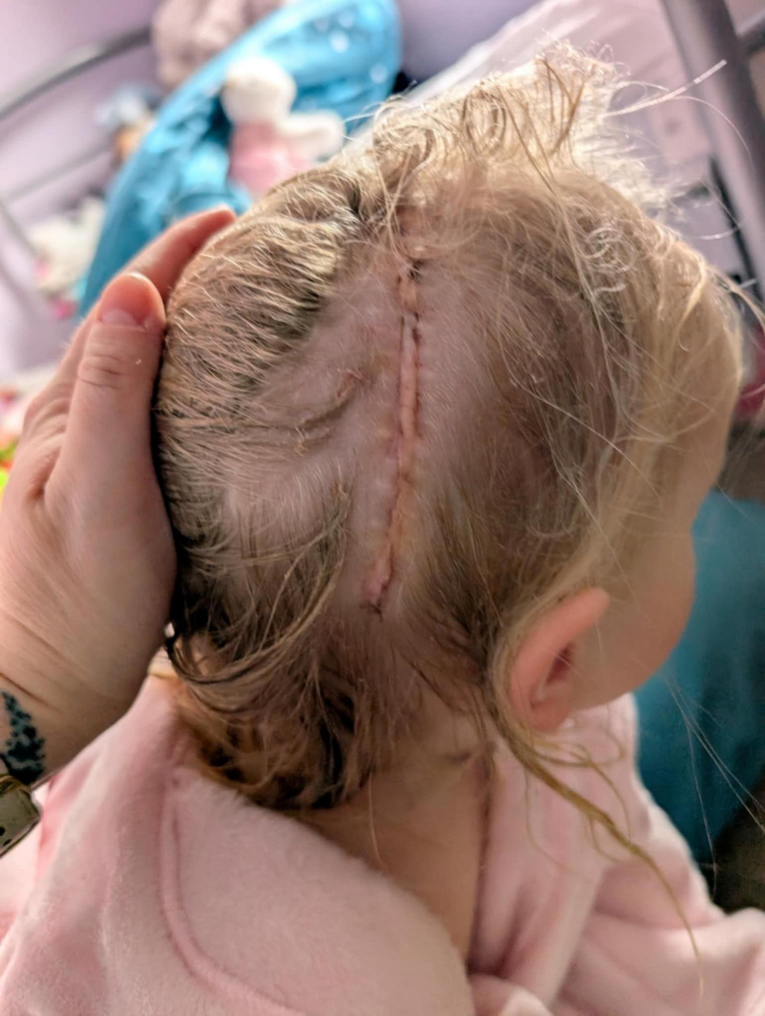 Close-up of the side of Molly's head, partially shaved where the incision was made during surgery. A large scar is visible across her scalp.