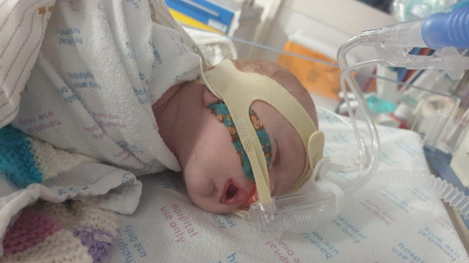 Harry, a newborn baby in an intensive care unit connected to a ventilator. 