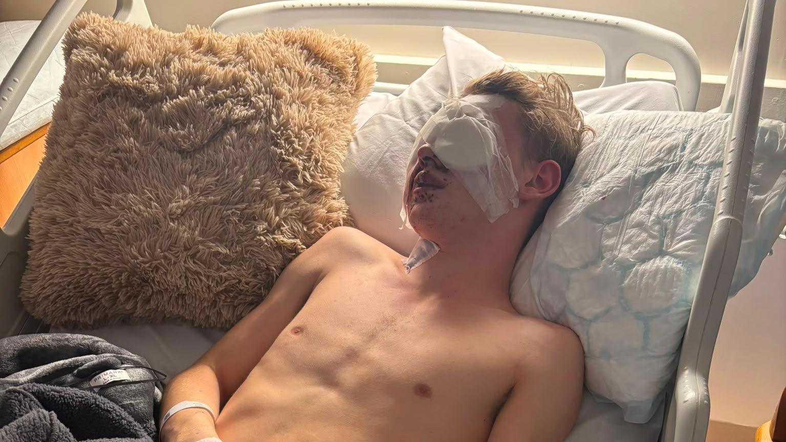 Teenage boy with brown hair and without a top on lying in a hospital bed propped up with pillow with his eyes bandaged up. 