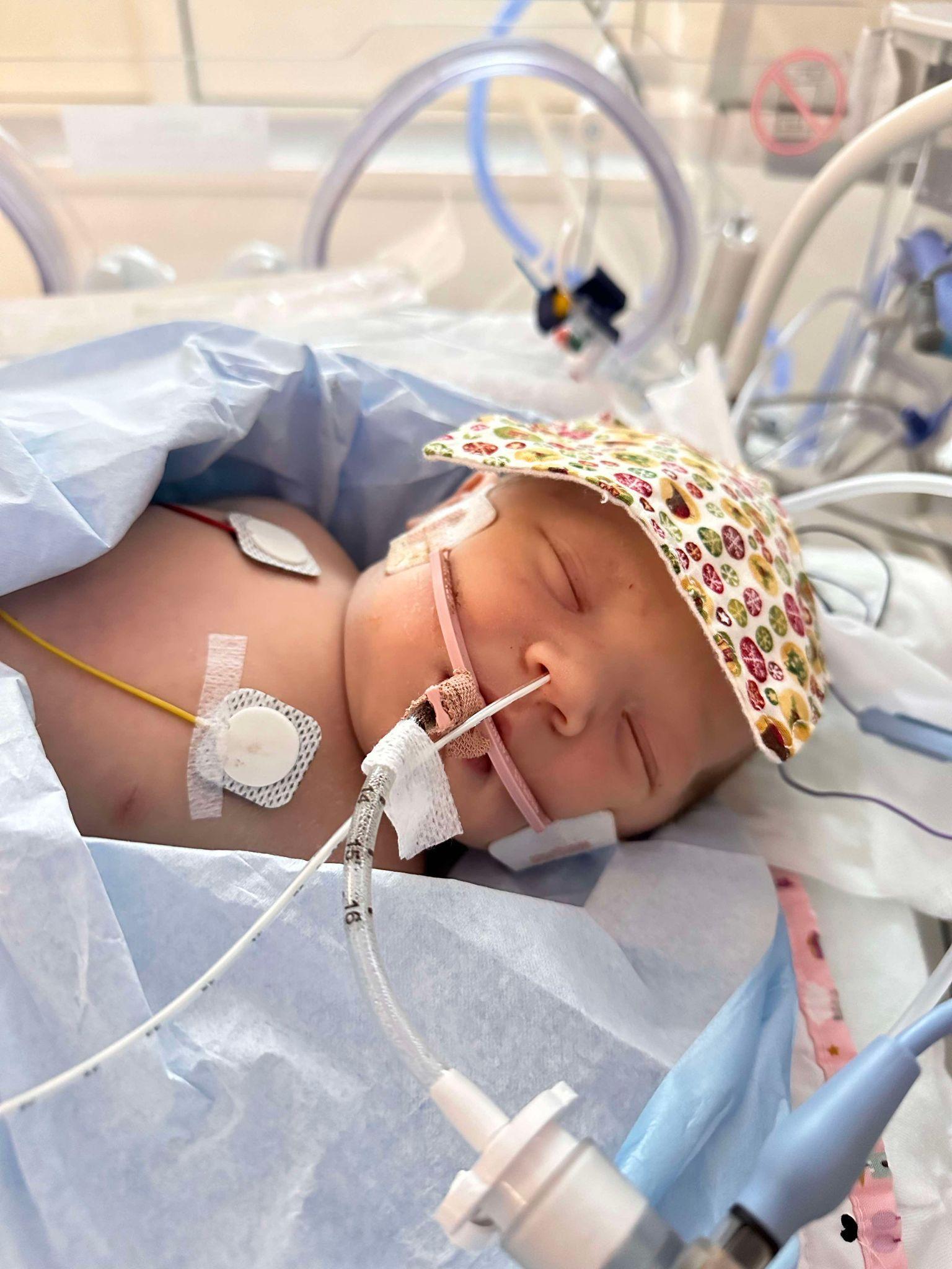 A newborn baby girl in intensive care with tubes and monitors attached to her chest, nose and mouth.